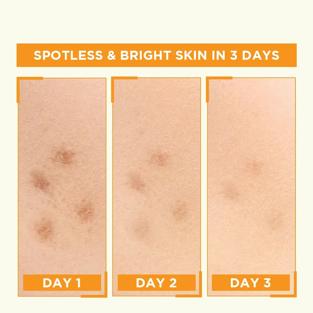 Garnier Skin Naturals Vitamin C Booster Serum – For Glowing Skin